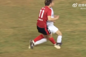 肿胀明显!博主晒三镇球员王毅脚踝被踩踏赛后情况